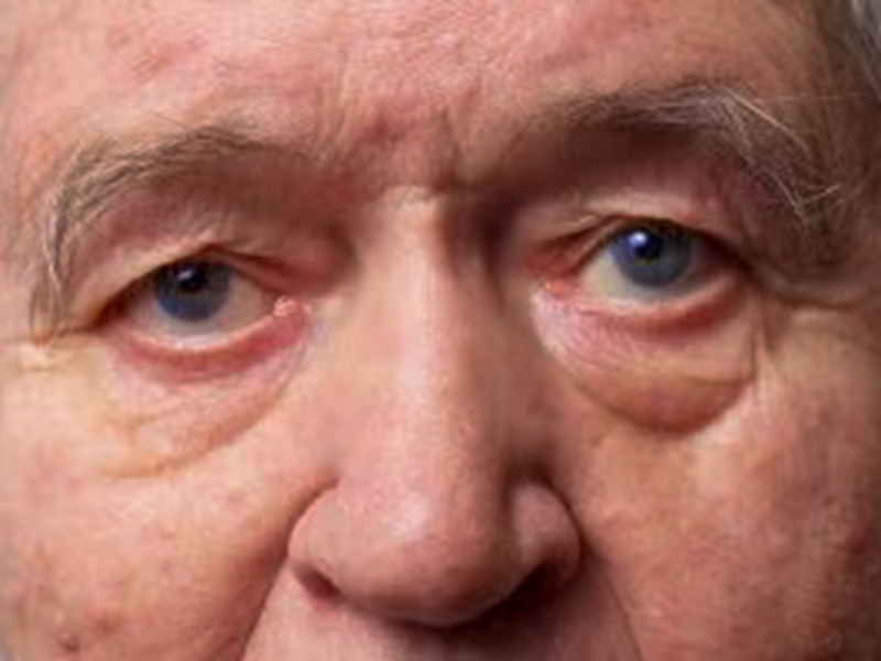 Cataracts Surgery in Derry, Windham, & Londonderry, NH